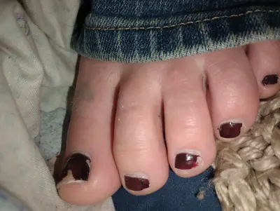 My sisters feet I took for my man cover image