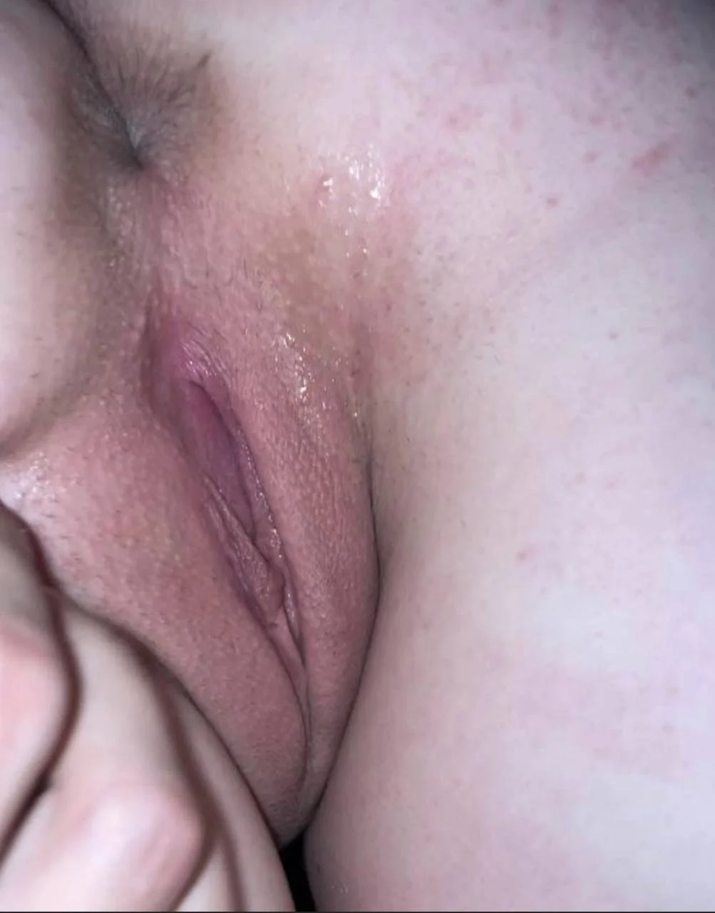 5 image 21