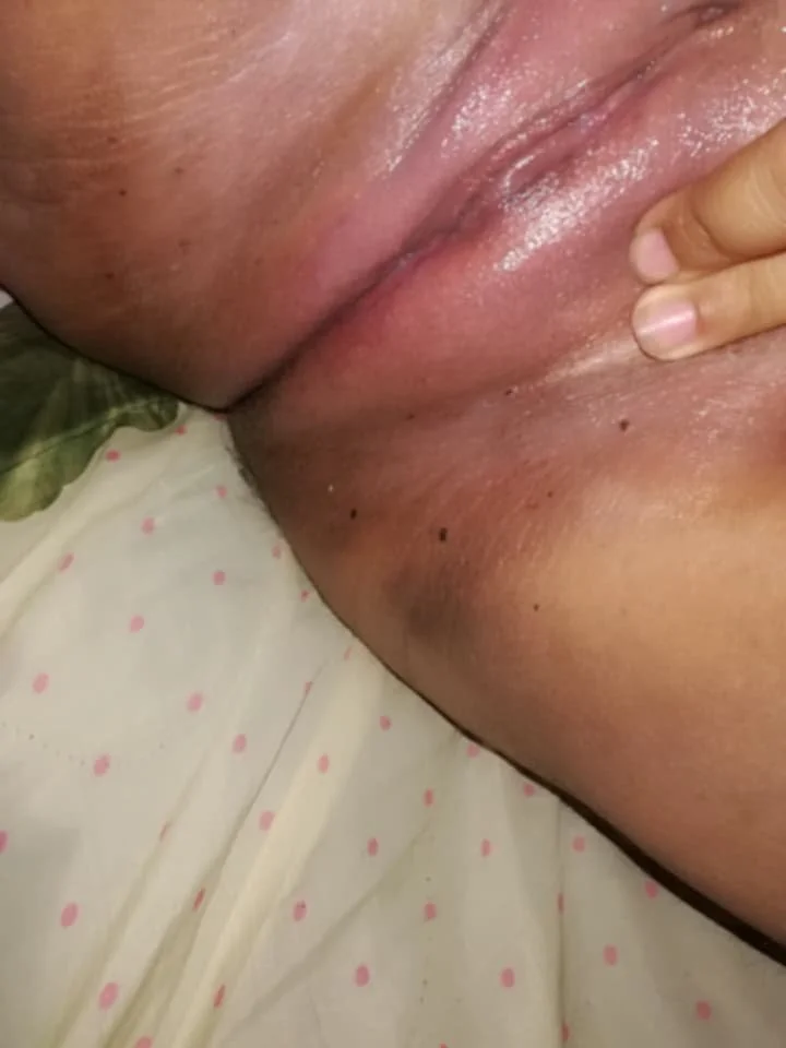 Morra Caliente Md para mas image 6