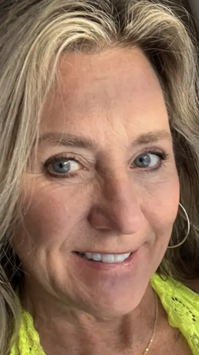 Admiring the ultimate GILF whore! The natural face is rare. Rocking granny body! Those nips tho🔥🔥 cover image