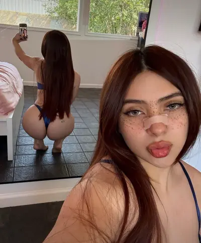 Freckle face POV cover image