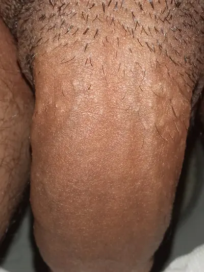 Pene grueso cover image