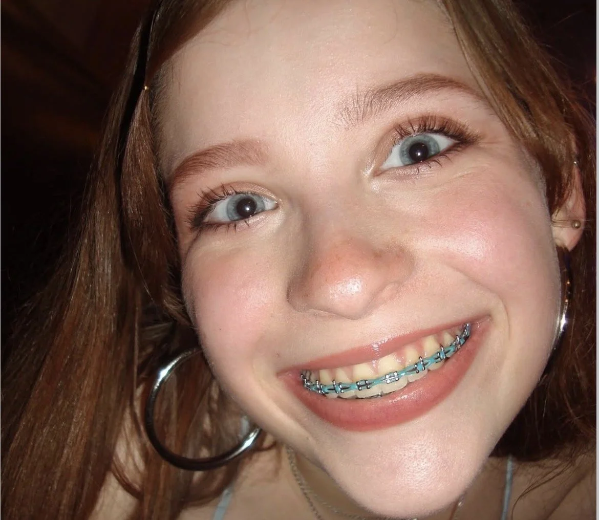 god i love sluts with braces image 4
