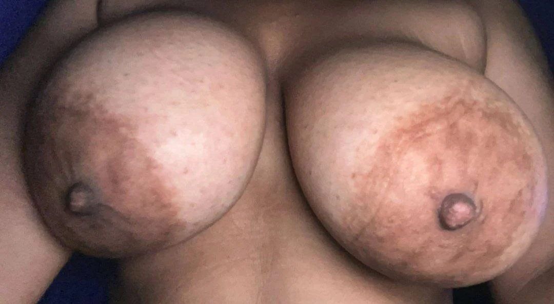 Cerda tetona main image