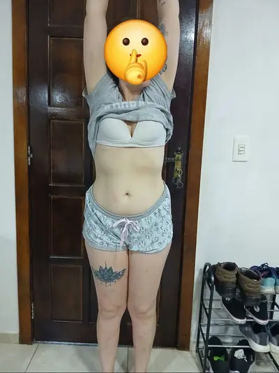 Marido vazou as fotos quando a esposa tava fazendo curativo no rabo branco dela tava assadinho,kkkkk cover image
