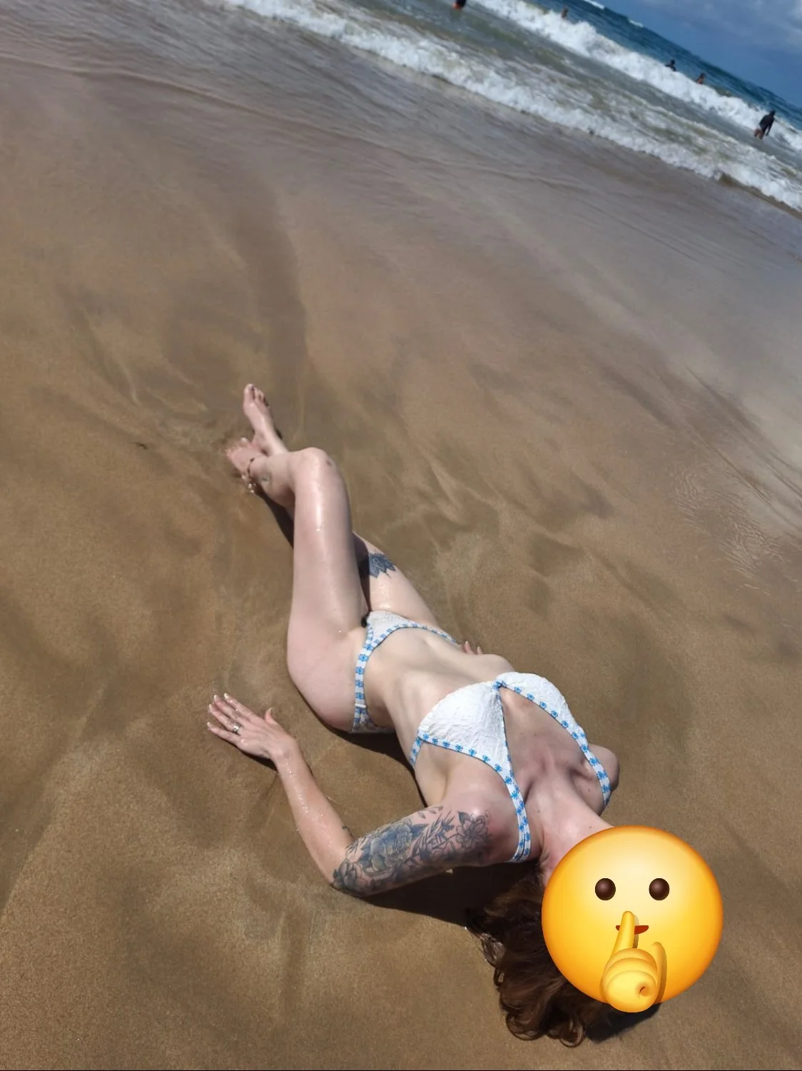 Marido vazou as fotos quando a esposa tava fazendo curativo no rabo branco dela tava assadinho,kkkkk image 2