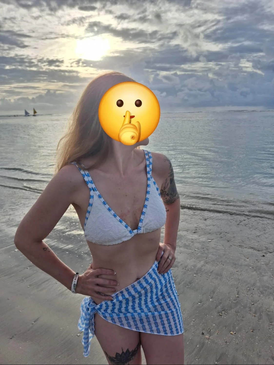 Marido vazou as fotos quando a esposa tava fazendo curativo no rabo branco dela tava assadinho,kkkkk image 4
