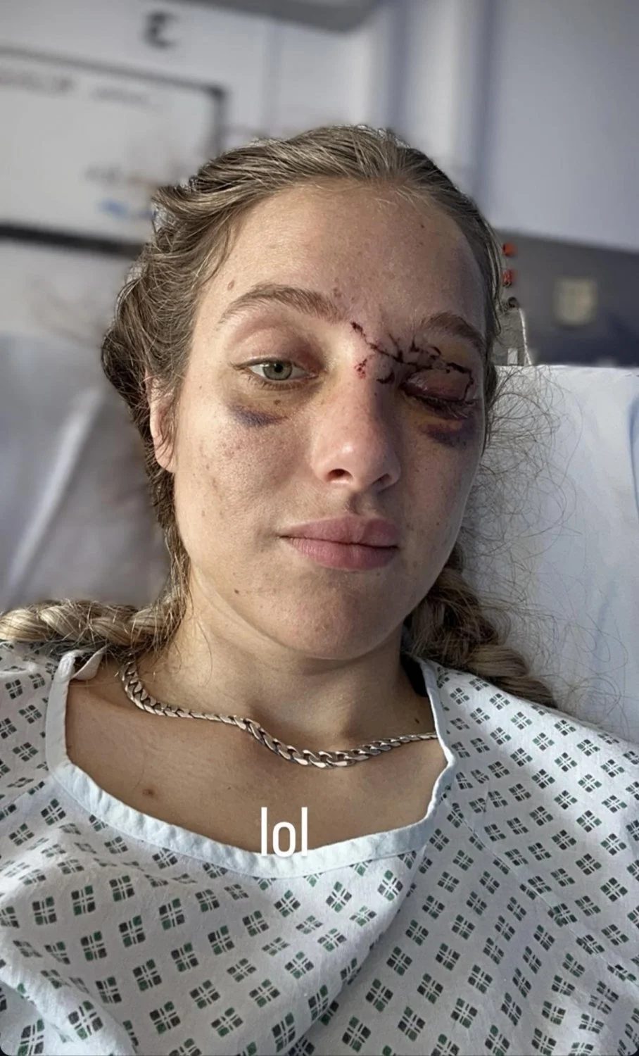 neuroscientist-turned-OF thot faces memory loss after pigeon caused motorcycle 🏍️ accident image 4