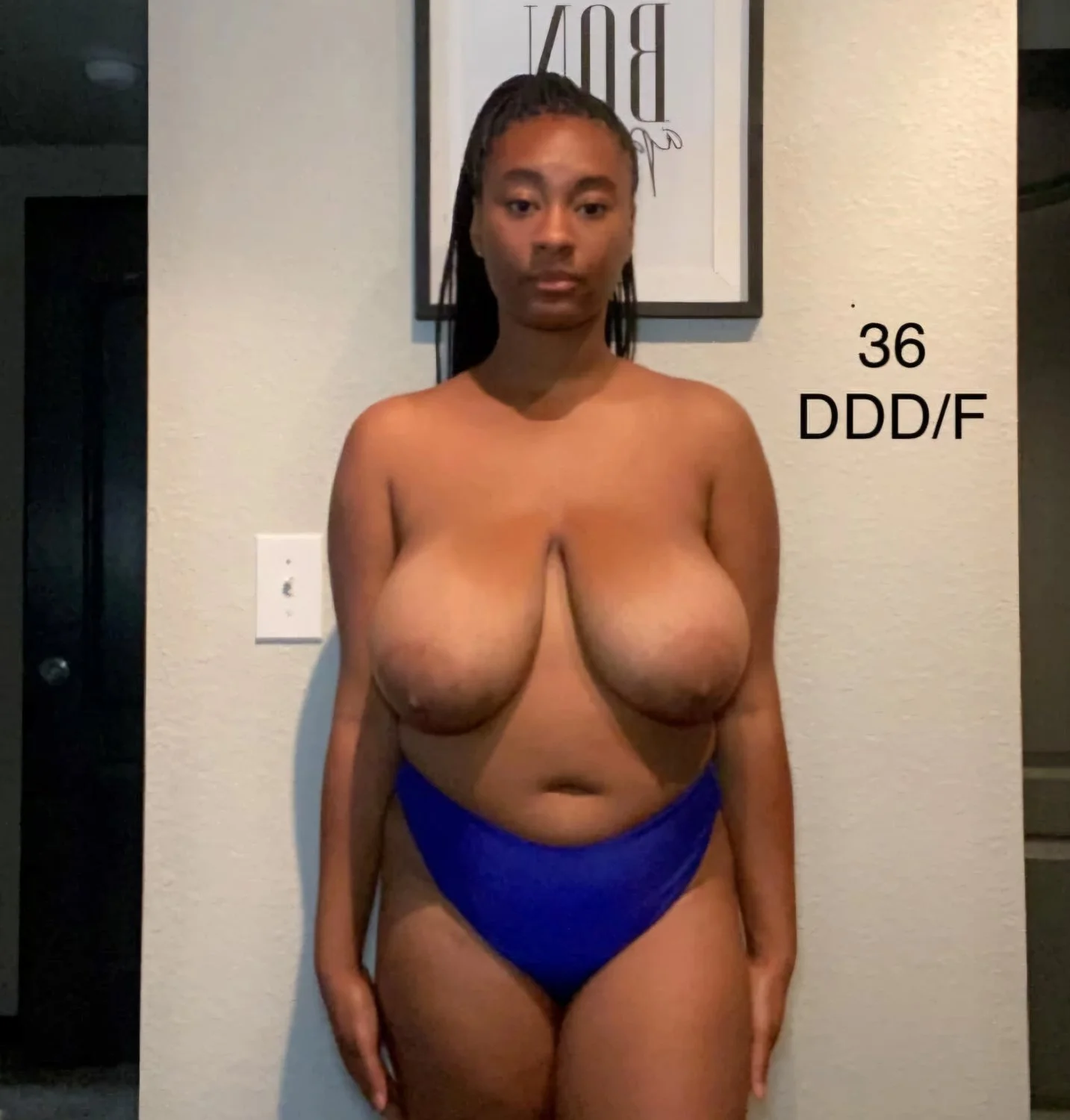 Huge Tits Before Reduction 6 image 25