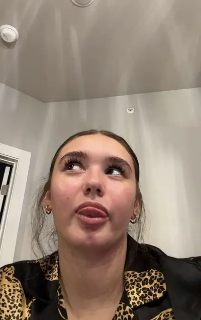 Ig live og cover image