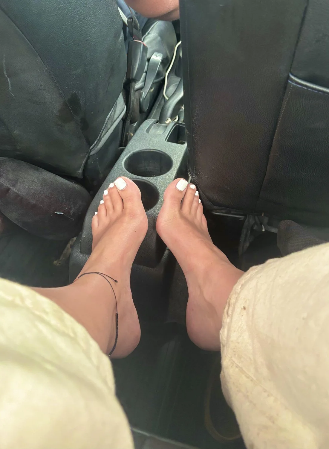 White toenails image 4
