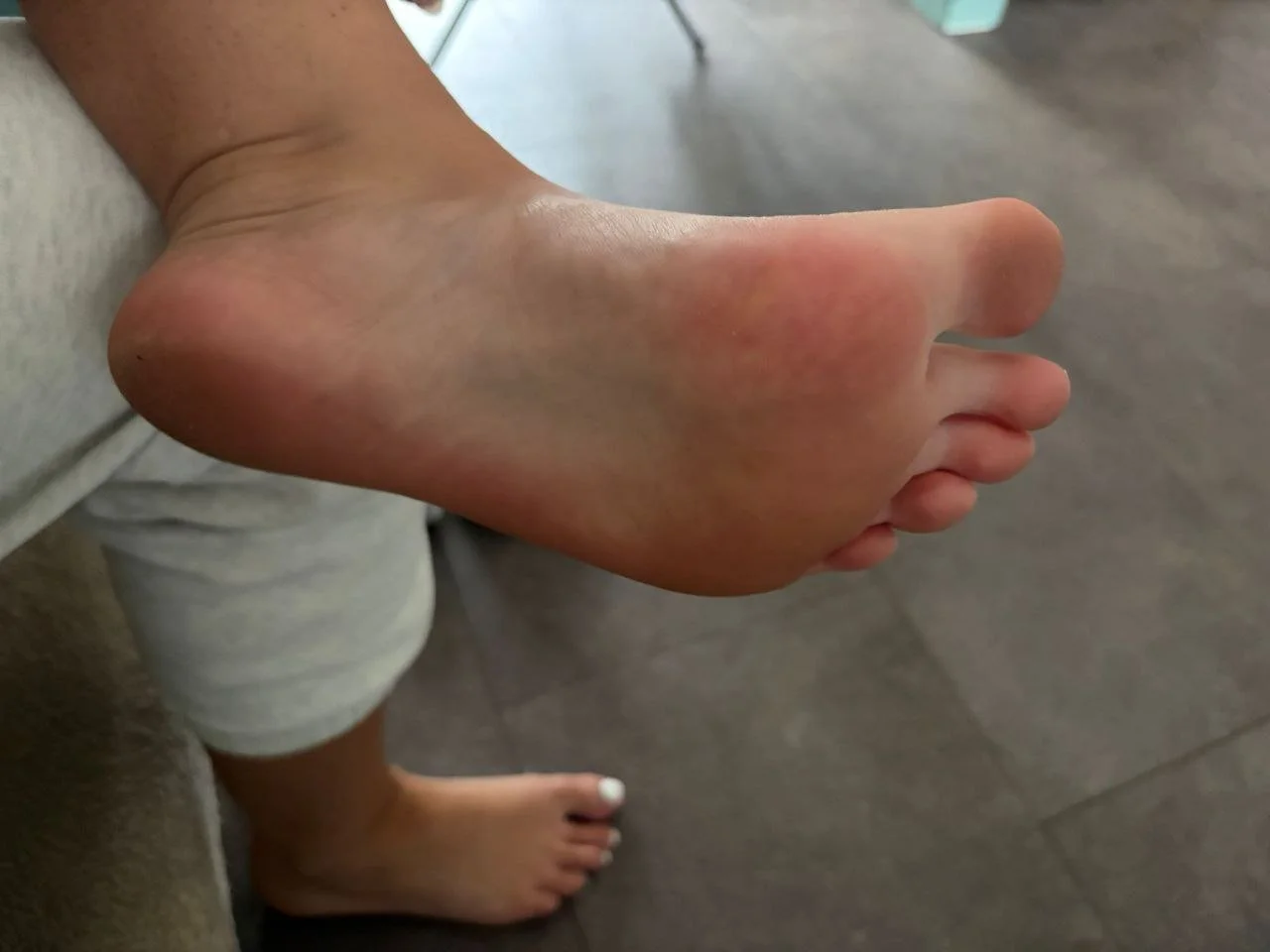 Tallulahs feet image 15