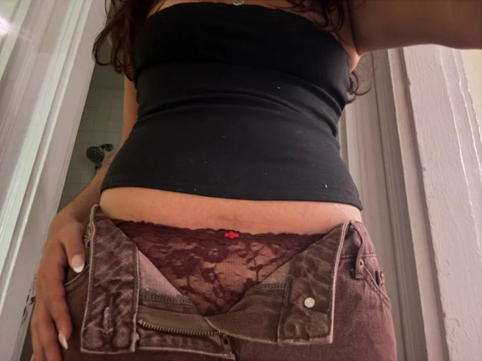 Kylie's Gross Stretch Marks image 18