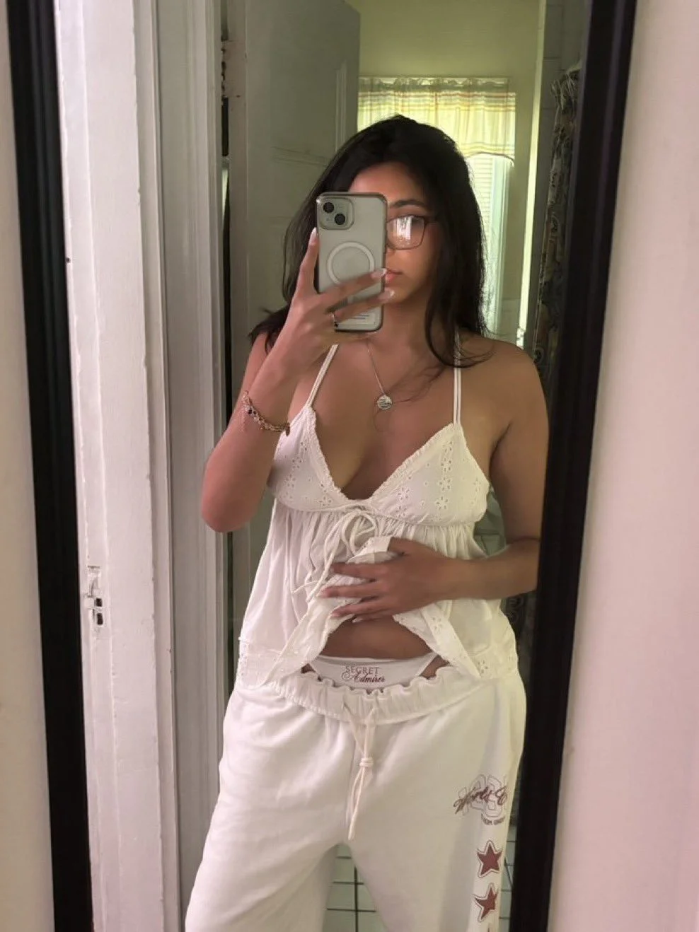 Kylie's Gross Stretch Marks image 22