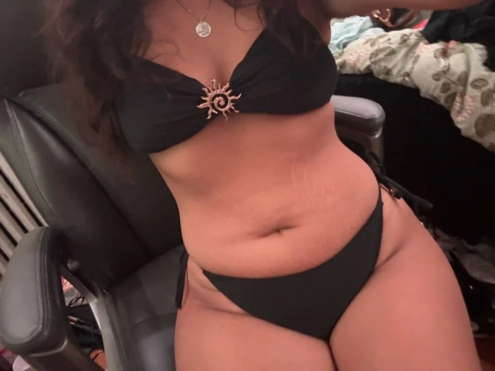 Kylie's Gross Stretch Marks image 3