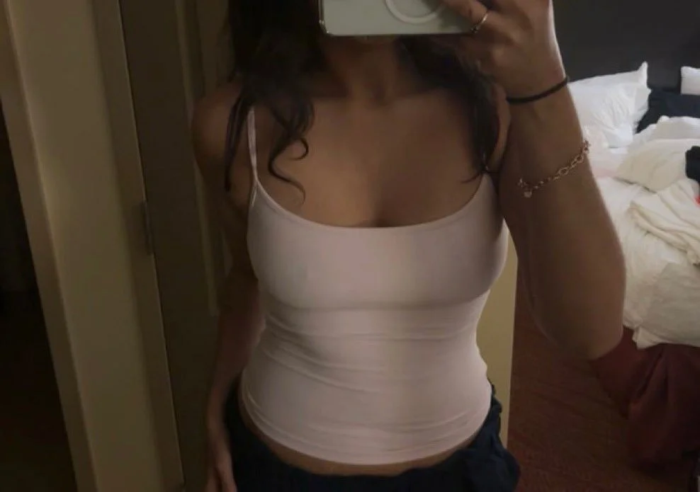 Kylie's Gross Stretch Marks image 48