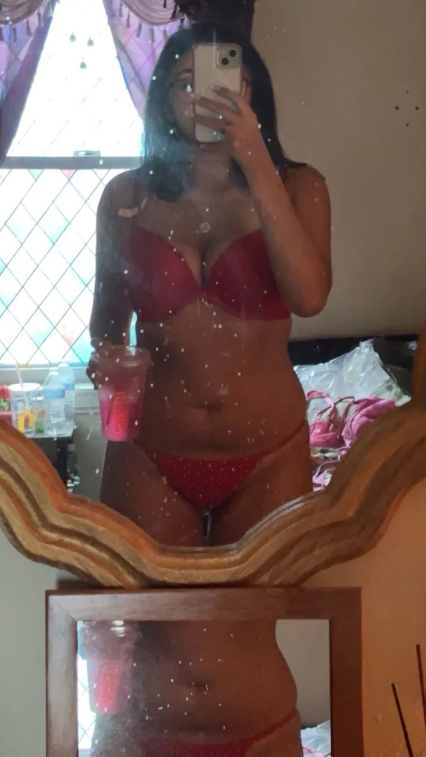 Kylie's Gross Stretch Marks image 8