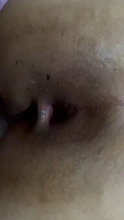 De novo a gordinha viciada em anal, tomando no cu e reclamando que vai ficar arrombada cover image