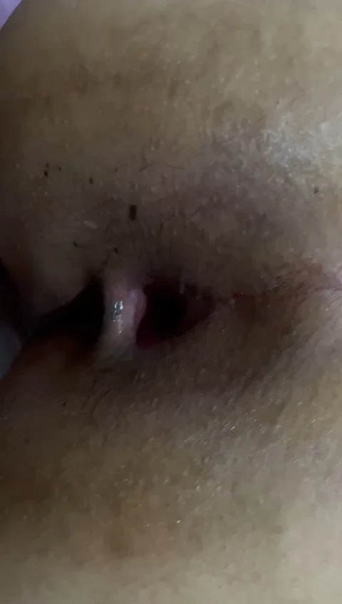 De novo a gordinha viciada em anal, tomando no cu e reclamando que vai ficar arrombada main image