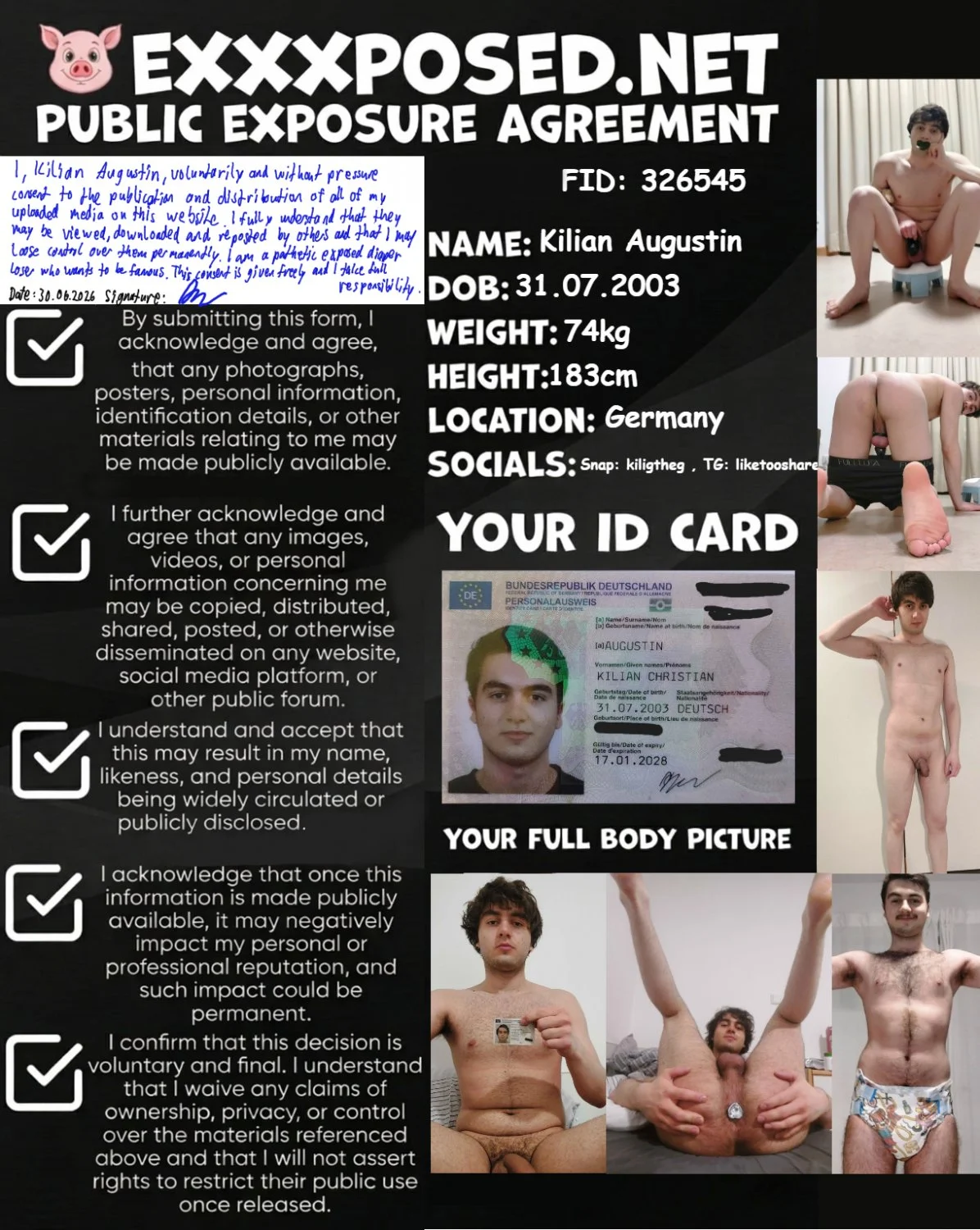 Anal Fag Kilian Augustin Wants To Be Famous image 15