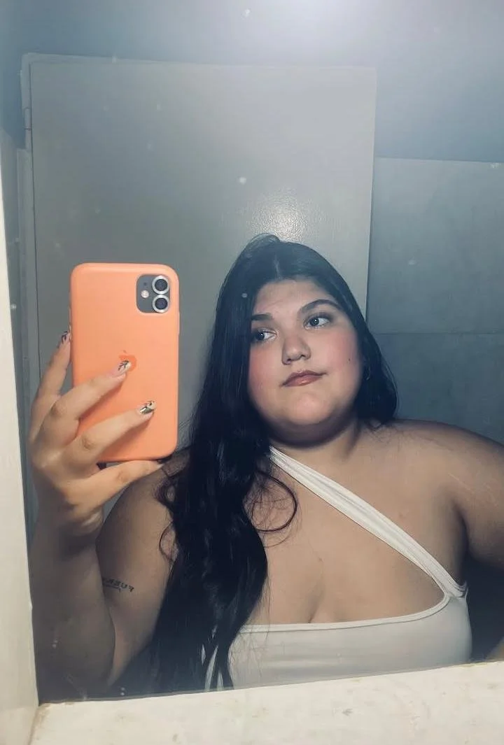 Gordita villa Mercedes San Luis, quemada x su pareja image 4