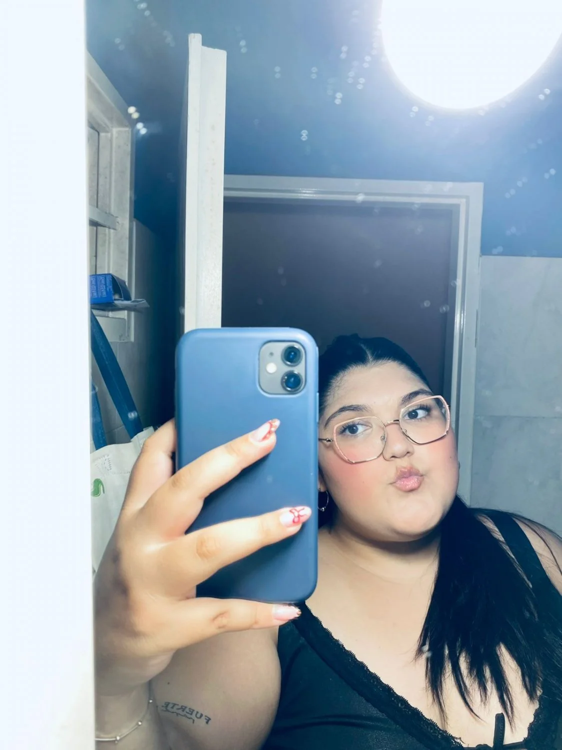 Gordita villa Mercedes San Luis, quemada x su pareja image 5