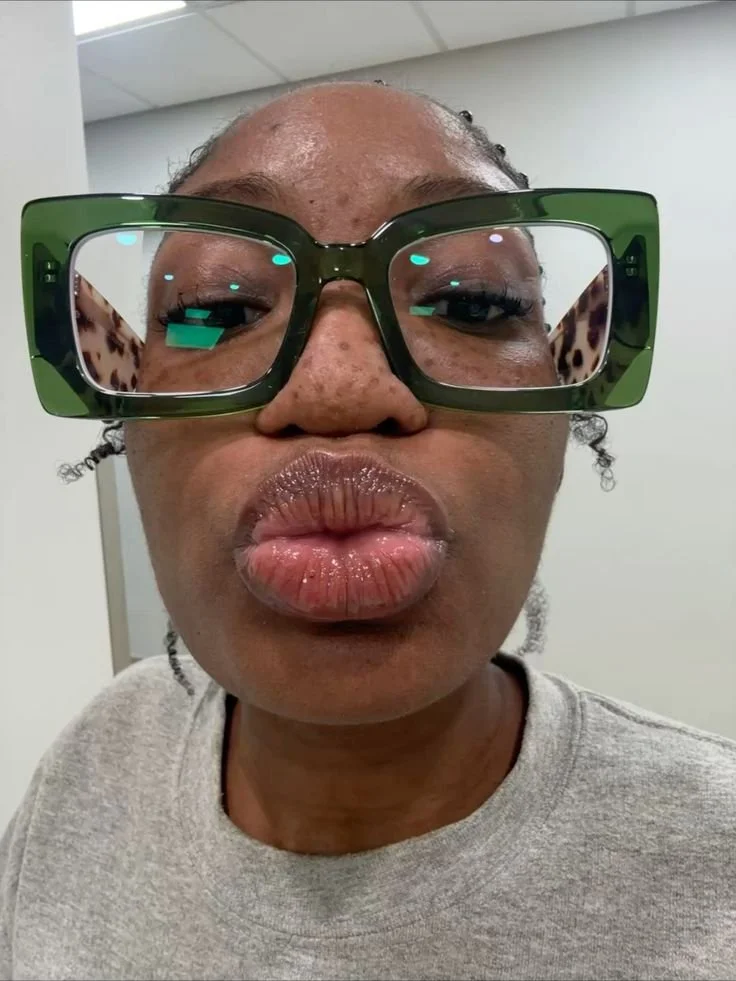 melhores labios do insta image 8