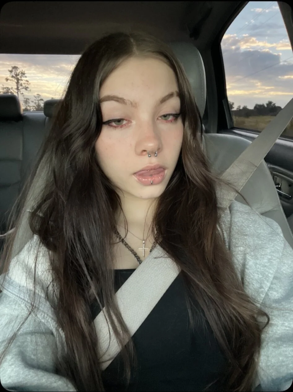 mia image 2