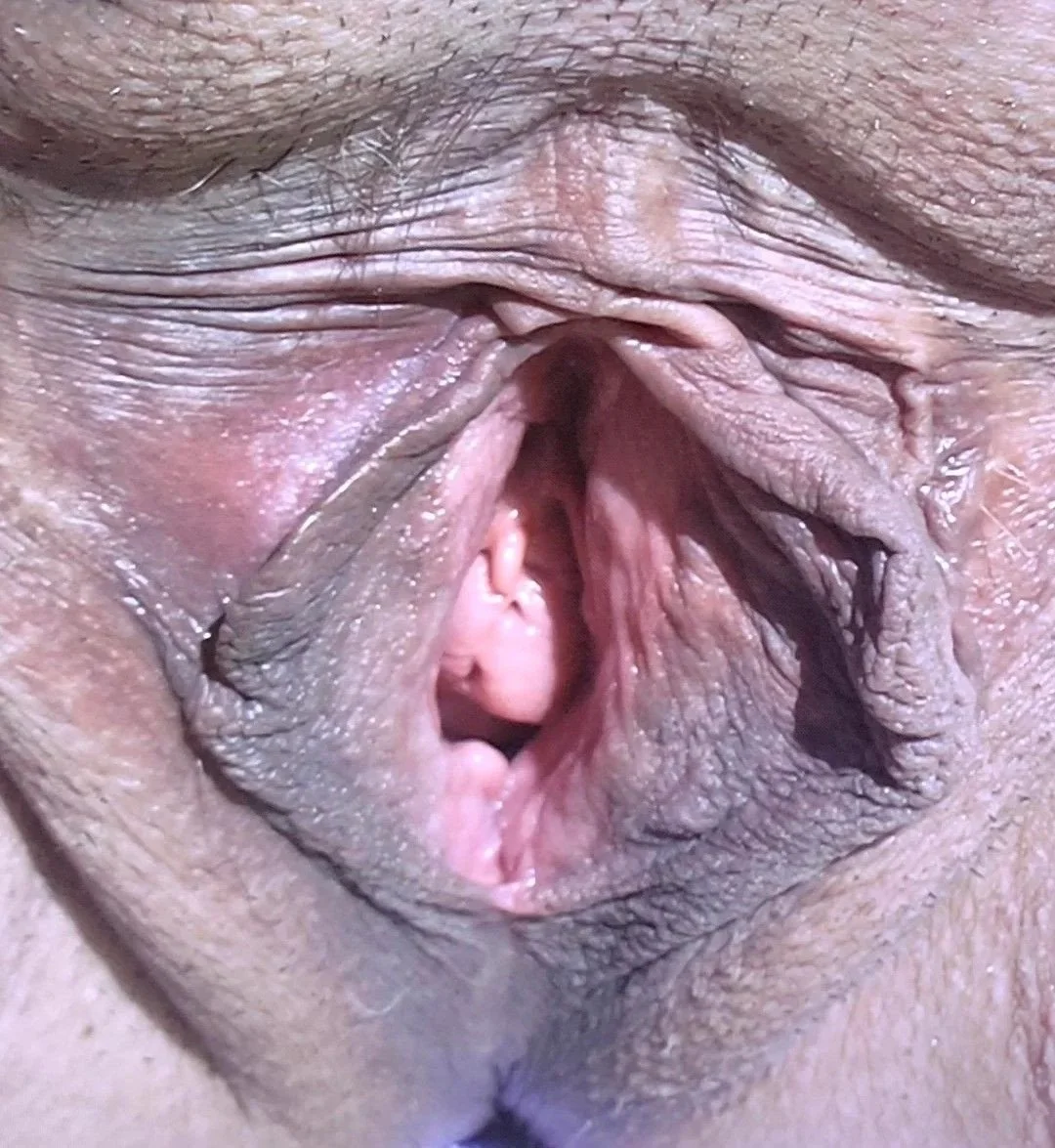 Vaginas image 7