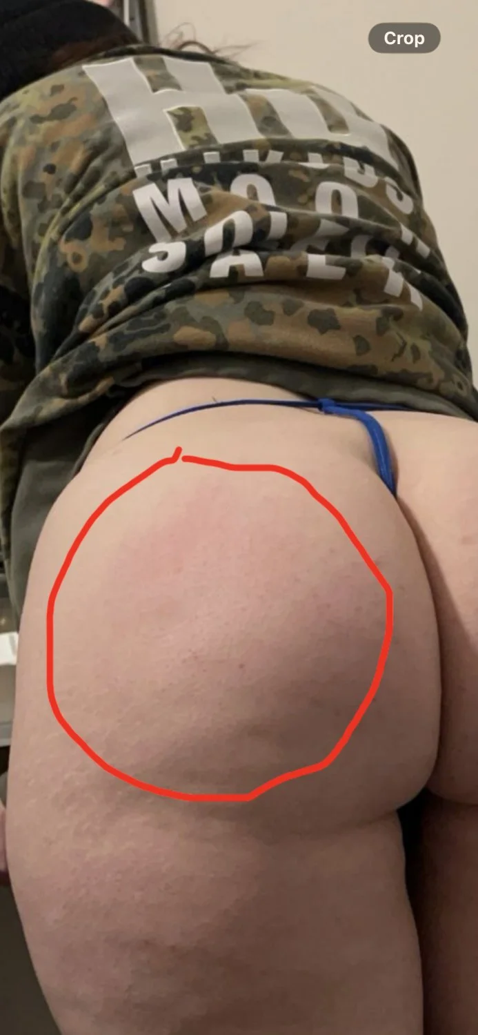 My gf got her ass spanked wearing these to the beach yesterday😅🍑 image 2