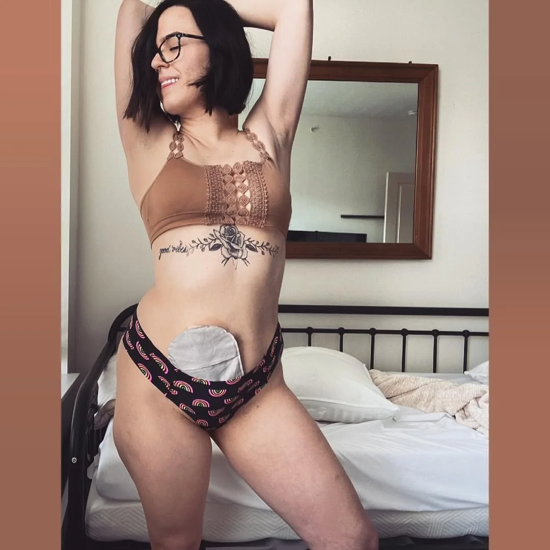 Disclosure #780: Queer & disabled image 12