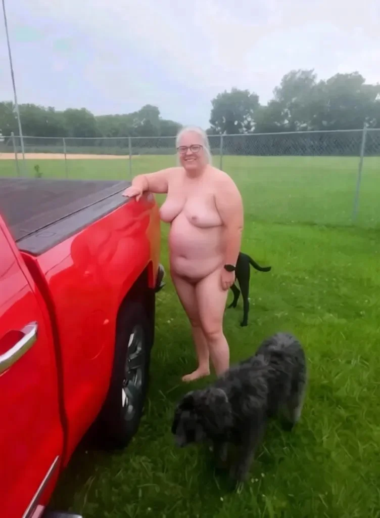 Chubby grandma nude with her dogs in public before and after breast reduction image 3