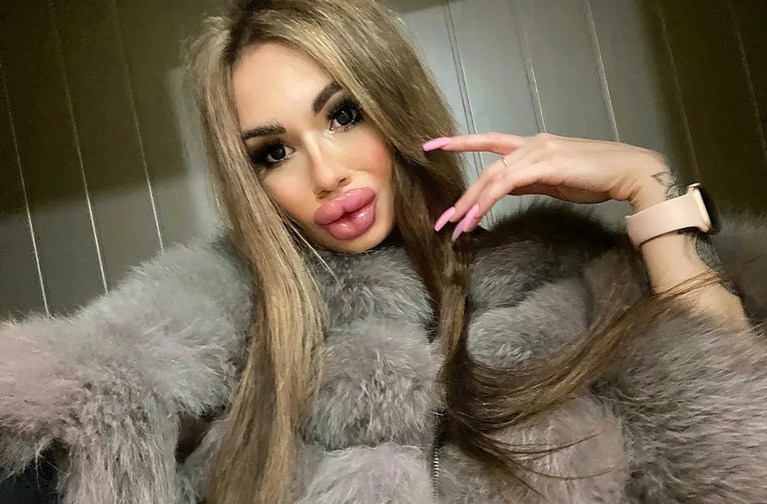 Bloated Bimbo Cock Kissers image 3