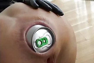 Extreme anal insertions image 35