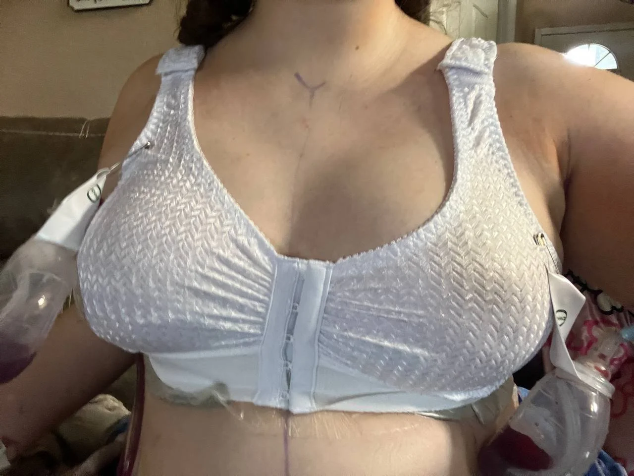 Another set of big tits got chopped smh.. main image