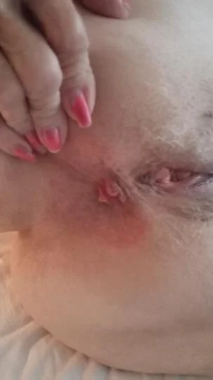 Nasty gilf 80 yr old nurse patty image 12