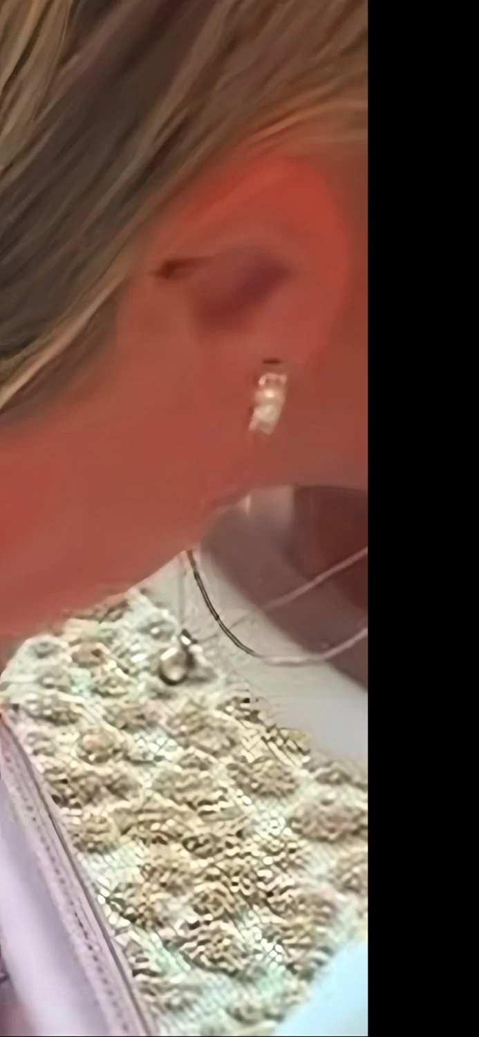 Nipple slip image 2