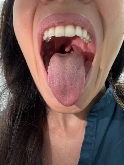 Do you need a review with the deep throat doctor? cover image