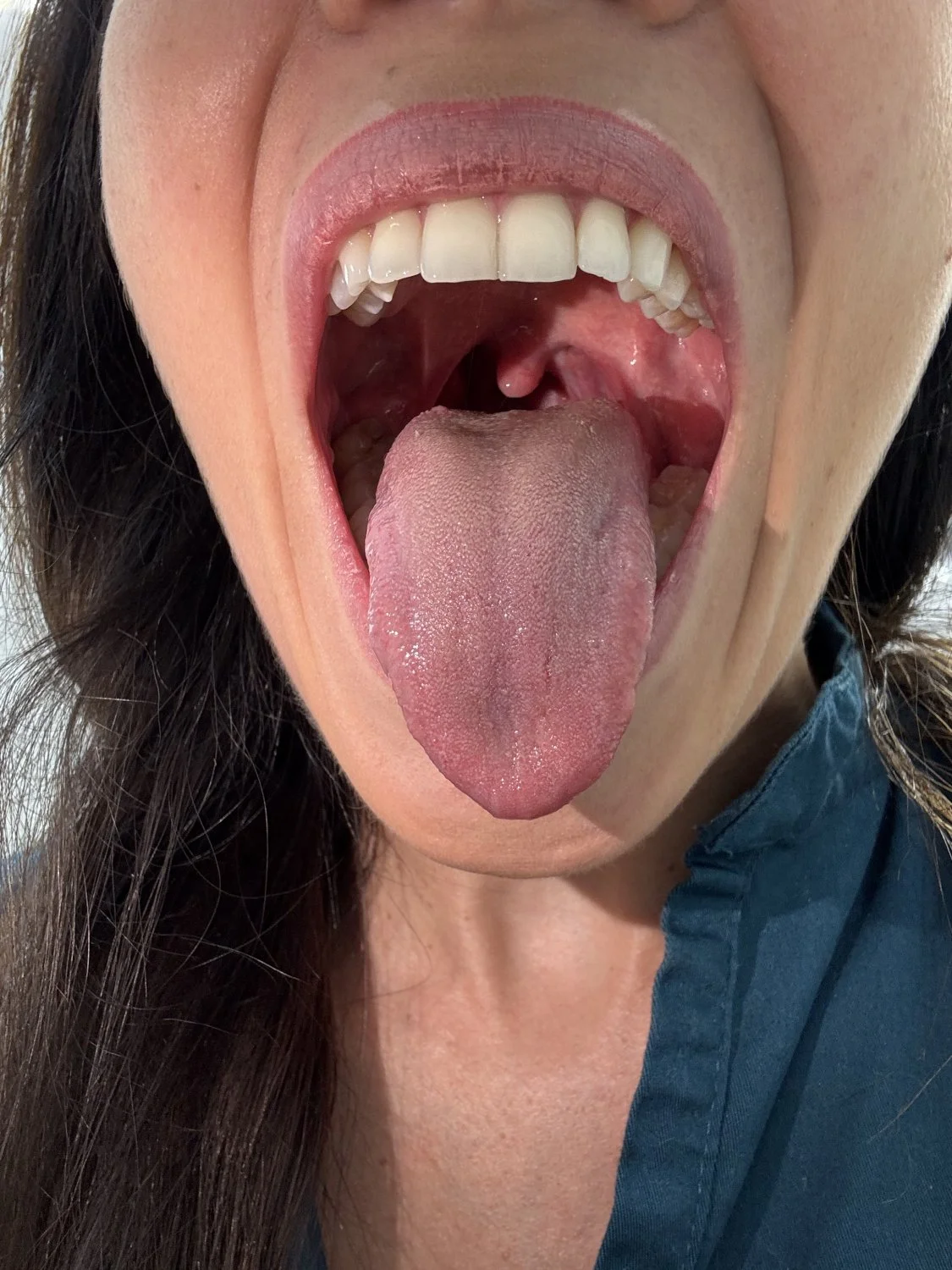 Do you need a review with the deep throat doctor? main image