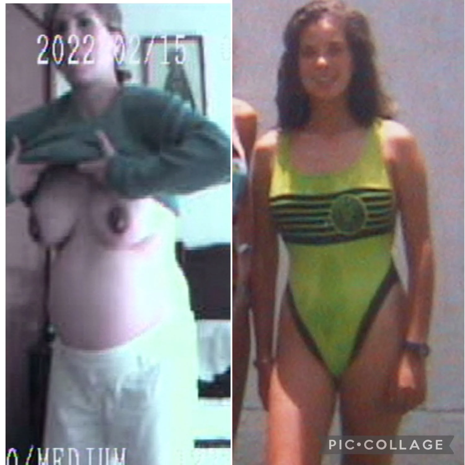 Facial and before and after pregnancy image 3