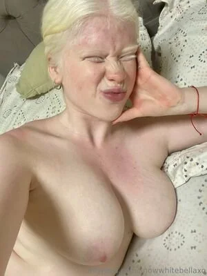 Albino chick image 14