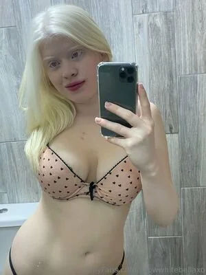 Albino chick image 7