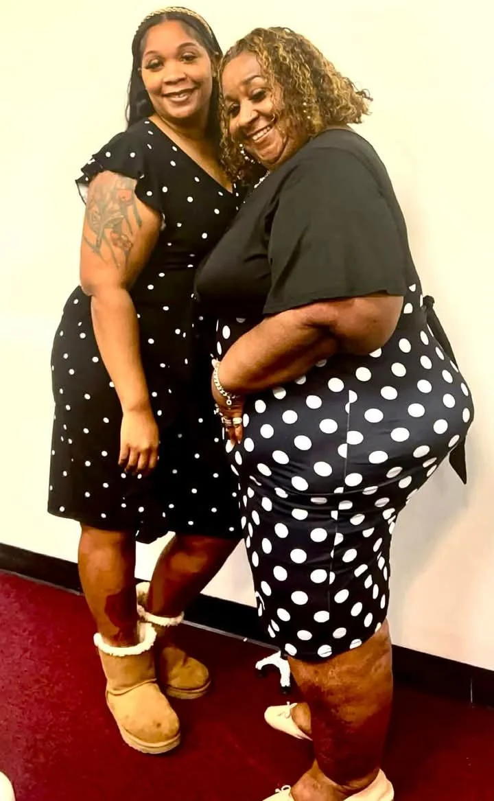 Swollen ankles nd all this is my dream woman Wanna Allen image 14
