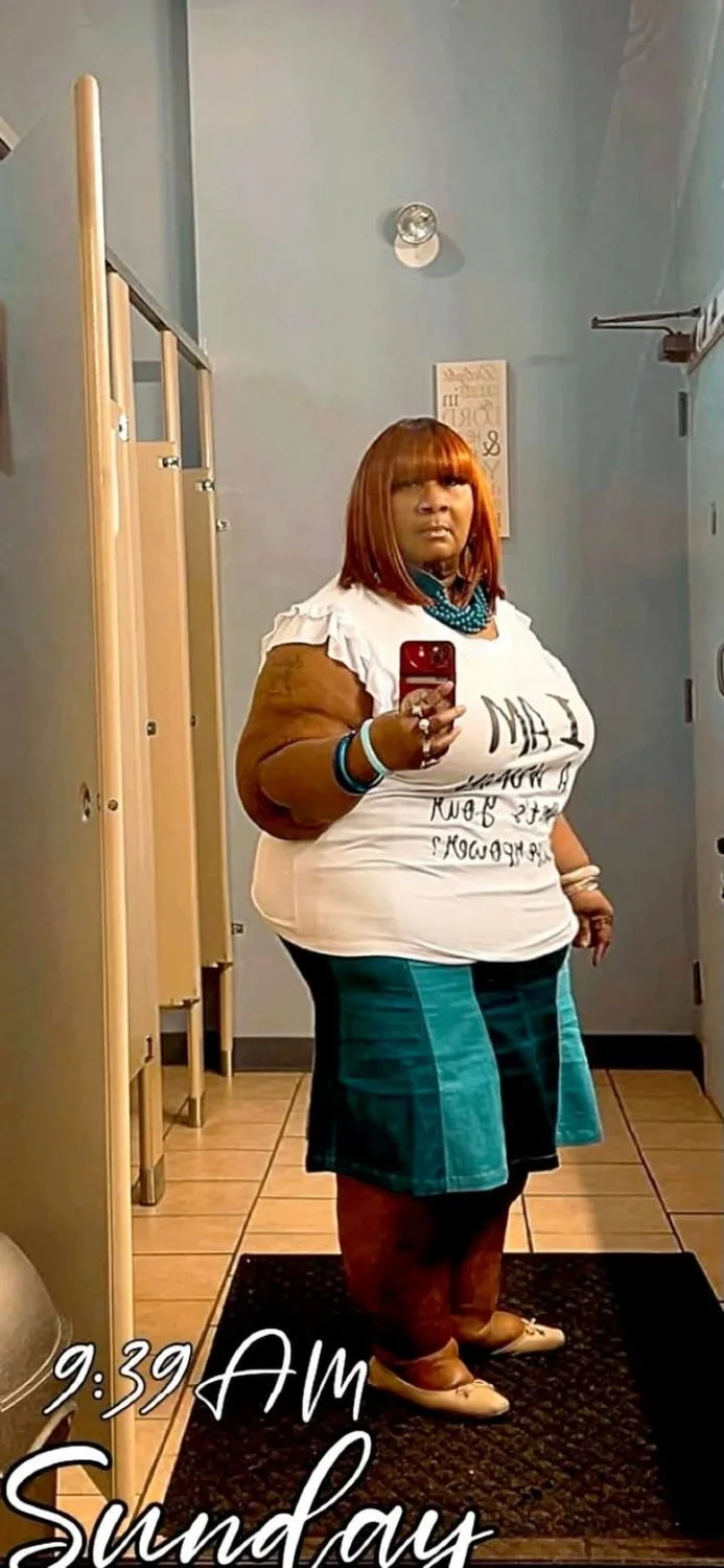 Swollen ankles nd all this is my dream woman Wanna Allen image 15