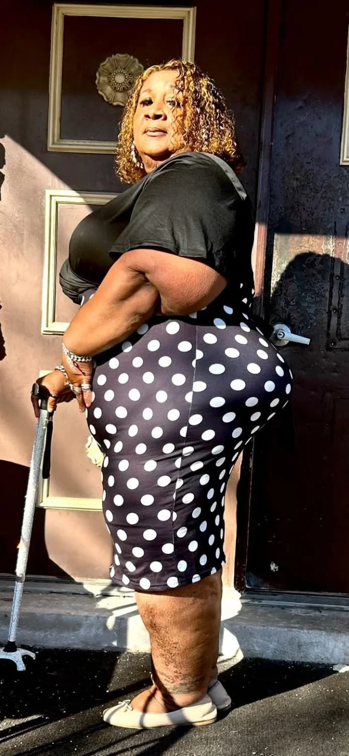 Swollen ankles nd all this is my dream woman Wanna Allen image 16