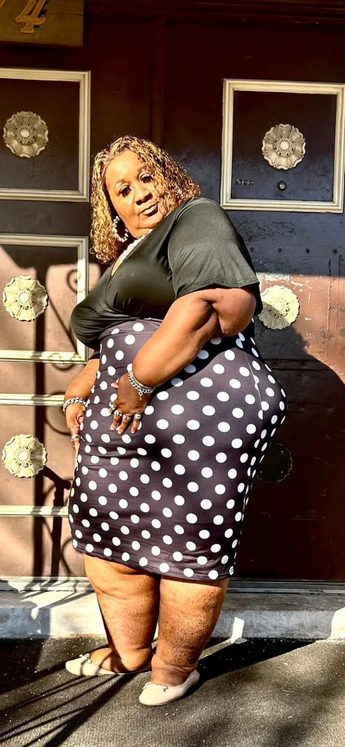 Swollen ankles nd all this is my dream woman Wanna Allen image 17