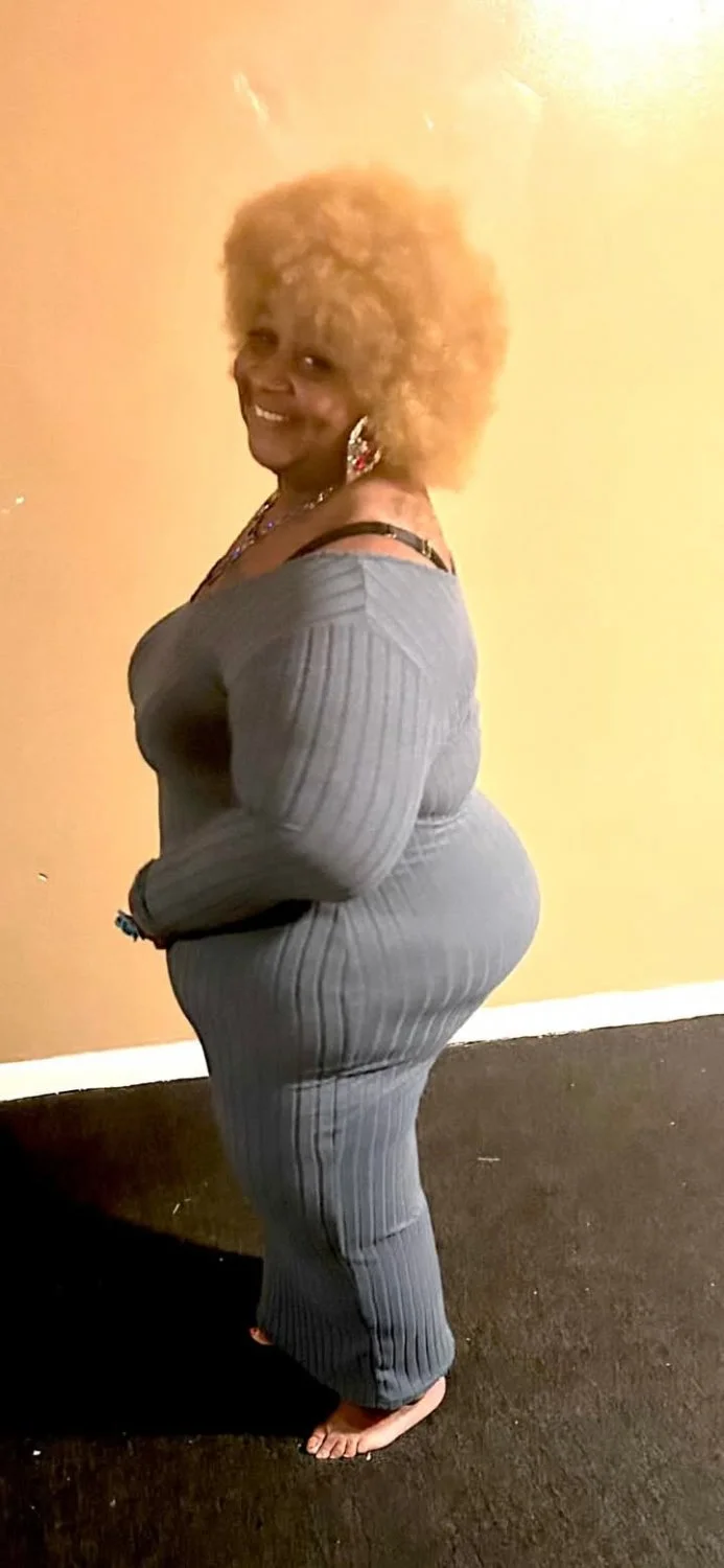 Swollen ankles nd all this is my dream woman Wanna Allen image 5
