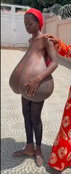 AFRICA CASE 3 image 2