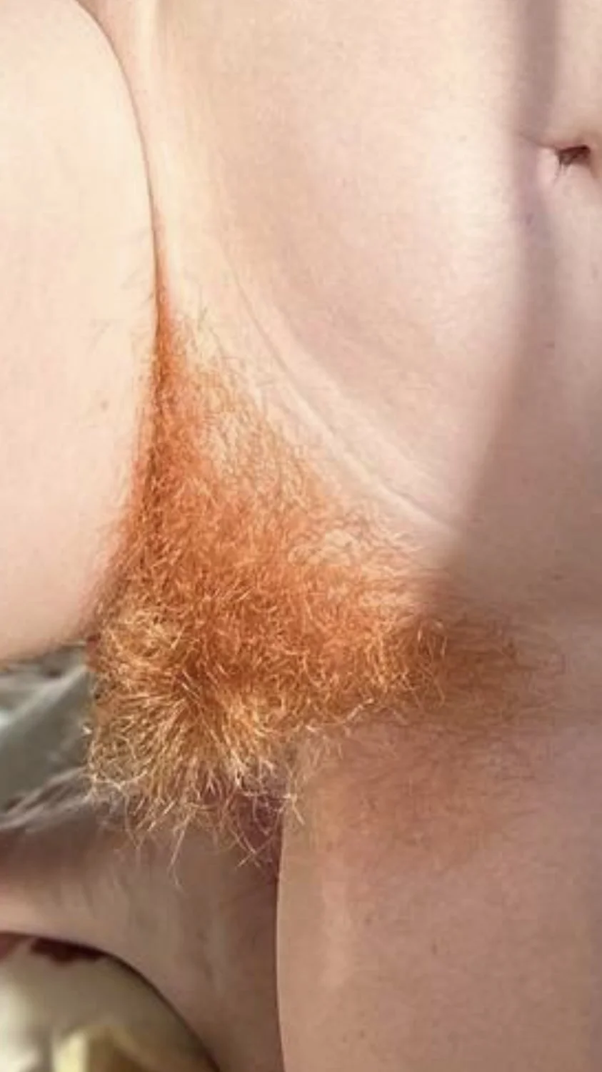 Gingers image 14