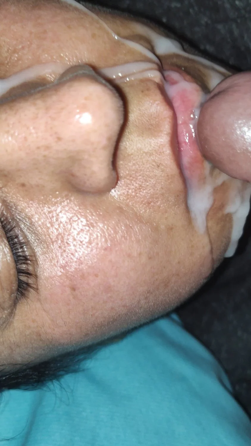 Narcolepsy image 3
